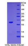 NUP210 / gp210 Protein - Recombinant Nucleoporin 210kDa By SDS-PAGE