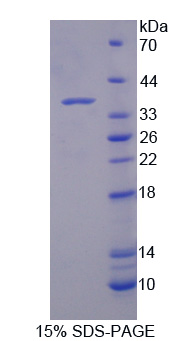 NUP214 / CAN Protein - Recombinant Nucleoporin 214kDa By SDS-PAGE