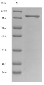 OCM / Oncomodulin Protein - (Tris-Glycine gel) Discontinuous SDS-PAGE (reduced) with 5% enrichment gel and 15% separation gel.