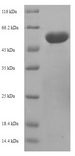 OGDH Protein - (Tris-Glycine gel) Discontinuous SDS-PAGE (reduced) with 5% enrichment gel and 15% separation gel.