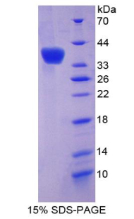 OLFM4 / Olfactomedin 4 Protein - Recombinant Olfactomedin 4 By SDS-PAGE