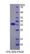 OPA3 Protein - Recombinant Optic Atrophy 3 (OPA3) by SDS-PAGE