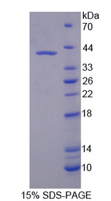 OPTN / Optineurin Protein - Recombinant Optineurin By SDS-PAGE