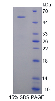 OSMR / IL-31R-Beta Protein - Recombinant  Oncostatin M Receptor By SDS-PAGE