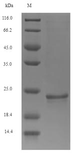 Osteocalcin Protein - (Tris-Glycine gel) Discontinuous SDS-PAGE (reduced) with 5% enrichment gel and 15% separation gel.