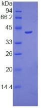 Osteocalcin Protein - Recombinant Osteocalcin By SDS-PAGE