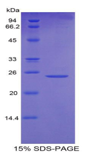 OSTF1 / OSF Protein - Recombinant Osteoclast Stimulating Factor 1 By SDS-PAGE