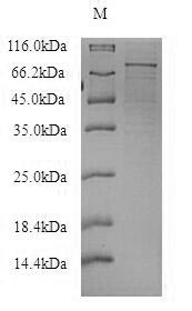 P2RX4 / P2X4 Protein - (Tris-Glycine gel) Discontinuous SDS-PAGE (reduced) with 5% enrichment gel and 15% separation gel.