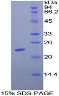 PACAP Protein - Recombinant Adenylate Cyclase Activating Polypeptide 1, Pituitary By SDS-PAGE