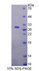 PAG1 Protein - Recombinant  Phosphoprotein Associated With Glycosphingolipid Microdomains 1 By SDS-PAGE