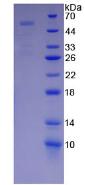 PAPPA / PAPP-A Protein - Recombinant Pregnancy Associated Plasma Protein A By SDS-PAGE