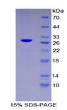 PARP1 Protein - Recombinant Poly ADP Ribose Polymerase By SDS-PAGE