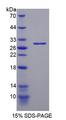 PARP1 Protein - Recombinant Poly ADP Ribose Polymerase By SDS-PAGE