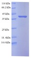 PC5 / PCSK5 Protein