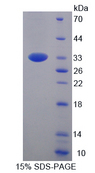 PCDH1 / PCD1 Protein - Recombinant  Protocadherin 1 By SDS-PAGE