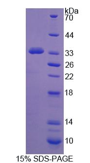 PCDH15 Protein - Recombinant Protocadherin 15 By SDS-PAGE