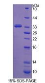 PCDH15 Protein - Recombinant Protocadherin 15 By SDS-PAGE