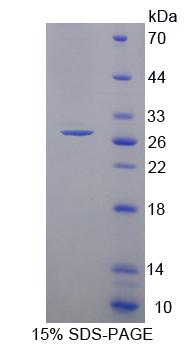 PCDHA1 Protein - Recombinant Protocadherin Alpha 1 By SDS-PAGE