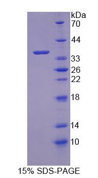 PCTK3 / CDK18 Protein - Recombinant Cyclin Dependent Kinase 18 (CDK18) by SDS-PAGE