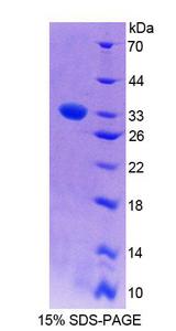 PCYOX1 Protein - Recombinant  Prenylcysteine Oxidase 1 By SDS-PAGE