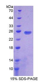 PD-L2 / PDCD1LG2 / CD273 Protein - Recombinant  Programmed Cell Death Protein 1 Ligand 2 By SDS-PAGE