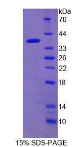 PDE12 Protein - Recombinant  Phosphodiesterase 12 By SDS-PAGE