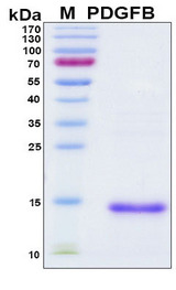 PDGF-BB Protein - SDS-PAGE under reducing conditions and visualized by Coomassie blue staining