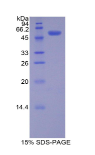 PDGF-BB Protein - Recombinant Platelet Derived Growth Factor BB By SDS-PAGE