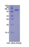 PDGF-BB Protein - Recombinant Platelet Derived Growth Factor BB By SDS-PAGE