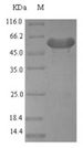 PDGF-D Protein - (Tris-Glycine gel) Discontinuous SDS-PAGE (reduced) with 5% enrichment gel and 15% separation gel.