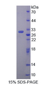 PDHX / Protein X / ProX Protein - Recombinant  Pyruvate Dehydrogenase Complex Component X By SDS-PAGE