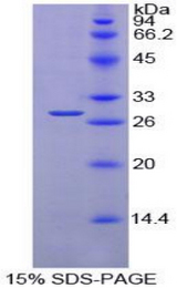 PDIA2 Protein - Recombinant Protein Disulfide Isomerase A2 By SDS-PAGE