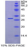 PDIA2 Protein - Recombinant Protein Disulfide Isomerase A2 By SDS-PAGE