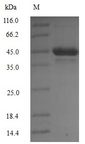 PDK1 Protein - (Tris-Glycine gel) Discontinuous SDS-PAGE (reduced) with 5% enrichment gel and 15% separation gel.
