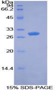 PDK1 Protein - Recombinant Pyruvate Dehydrogenase Kinase Isozyme 1 By SDS-PAGE