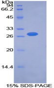 PDK2 Protein - Recombinant Pyruvate Dehydrogenase Kinase Isozyme 2 By SDS-PAGE