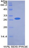 PDK2 Protein - Recombinant Pyruvate Dehydrogenase Kinase Isozyme 2 By SDS-PAGE