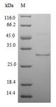 PDK3 Protein - (Tris-Glycine gel) Discontinuous SDS-PAGE (reduced) with 5% enrichment gel and 15% separation gel.