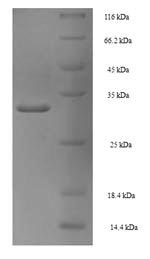 PDK4 Protein - (Tris-Glycine gel) Discontinuous SDS-PAGE (reduced) with 5% enrichment gel and 15% separation gel.