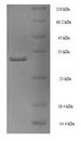 PDK4 Protein - (Tris-Glycine gel) Discontinuous SDS-PAGE (reduced) with 5% enrichment gel and 15% separation gel.