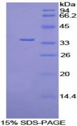 PDK4 Protein - Recombinant Pyruvate Dehydrogenase Kinase Isozyme 4 By SDS-PAGE