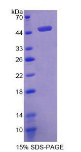 PDPN / Podoplanin Protein - Recombinant  Podoplanin By SDS-PAGE