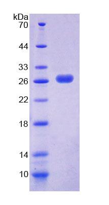 PEX1 Protein - Recombinant  Peroxisomal Biogenesis Factor 1 By SDS-PAGE