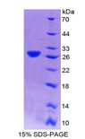 PFKP Protein - Recombinant  Phosphofructokinase, Platelet By SDS-PAGE