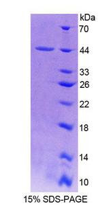 PFN3 Protein - Recombinant Profilin 3 By SDS-PAGE