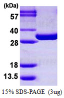 PGAM1 Protein