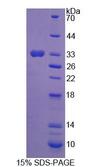 PGAM2 Protein - Recombinant Phosphoglycerate Mutase 2, Muscle By SDS-PAGE