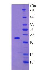 PGLYRP1 / PGRP Protein - Recombinant Peptidoglycan Recognition Protein 1 By SDS-PAGE