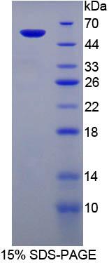 PGP Protein - Recombinant  Phosphoglycolate Phosphatase By SDS-PAGE