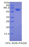 PHAP1 / ANP32A Protein - Recombinant Acidic Nuclear Phosphoprotein 32 Family, Member A By SDS-PAGE